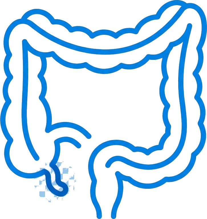 Appendix Removal