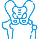 Hip Replacement