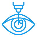 LASIK