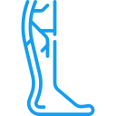Varicose Veins